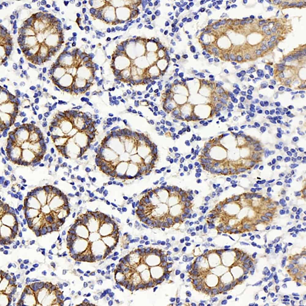 Immunohistochemistry analysis of paraffin-embedded human colon using Claudin 5 Polyclonal Antibody at dilution of 1:400.