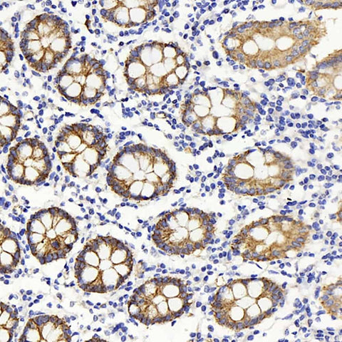 Immunohistochemistry analysis of paraffin-embedded human colon using Claudin 5 Polyclonal Antibody at dilution of 1:400.