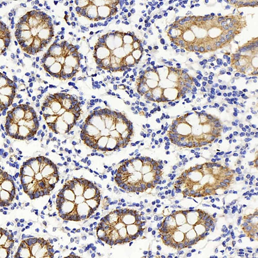 Immunohistochemistry analysis of paraffin-embedded human colon using Claudin 5 Polyclonal Antibody at dilution of 1:400.