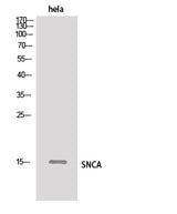 Western Blot analysis of Hela cells using SNCA Polyclonal Antibody.
