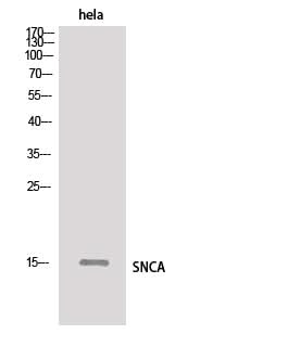 Western Blot analysis of Hela cells using SNCA Polyclonal Antibody.