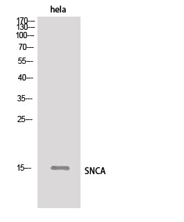 Western Blot analysis of Hela cells using SNCA Polyclonal Antibody.