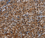 Anti-Human/Mouse DCAF6 Antibody - ABMIUM