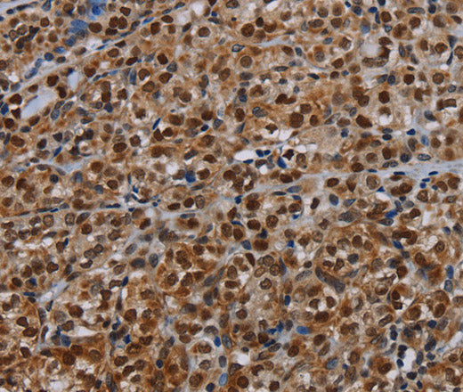 Anti-Human/Mouse DCAF6 Antibody - ABMIUM