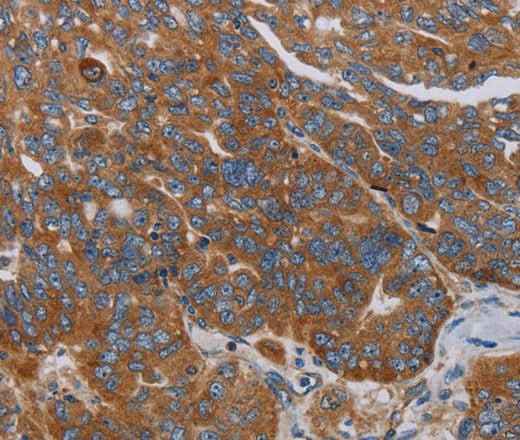 Anti-Human PARP10 Antibody