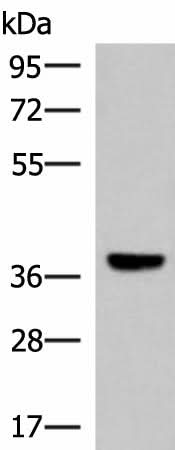 Western blot analysis of Mouse liver tissue lysate using LRG1 Polyclonal Antibody at dilution of 1:1000