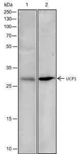 Anti-Rat/Mouse UCP1 Antibody [A385]