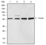 Anti-Human PRAME Antibody [A513]