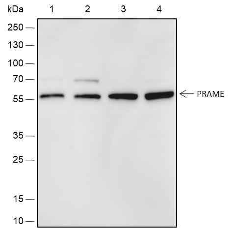 Anti-Human PRAME Antibody [A513] - ABMIUM