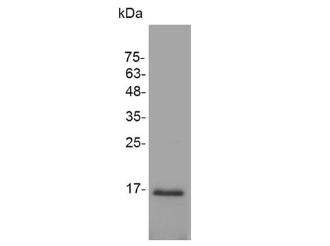 Recombinant Mouse TGF beta 1 protein(His Tag) - ABMIUM