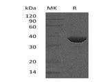 Recombinant Human FBPase 1/FBP1 Protein (Human Cells, His Tag) - ABMIUM