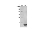 SDS-PAGE analysis of Human CXCL5 proteins, 2 μg/lane of Recombinant Human CXCL5 proteins was resolved with SDS-PAGE under reducing conditions, showing bands at 8 kDa.