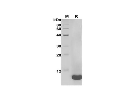 SDS-PAGE analysis of Human CXCL5 proteins, 2 μg/lane of Recombinant Human CXCL5 proteins was resolved with SDS-PAGE under reducing conditions, showing bands at 8 kDa.