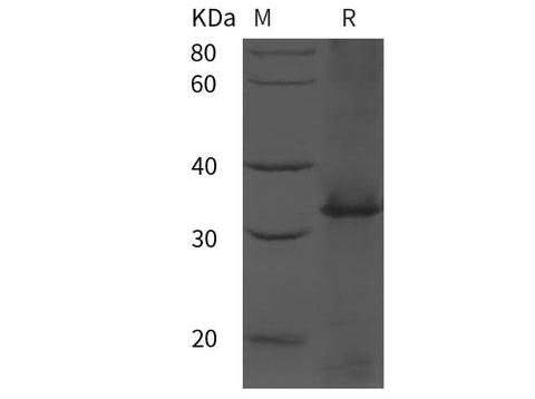 SDS-PAGE analysis of Human IL7R/IL-7R/CD127 proteins, 2 μg/lane of Recombinant Human IL7R/IL-7R/CD127 proteins was resolved with SDS-PAGE under reducing conditions, showing bands at 25 kDa.
