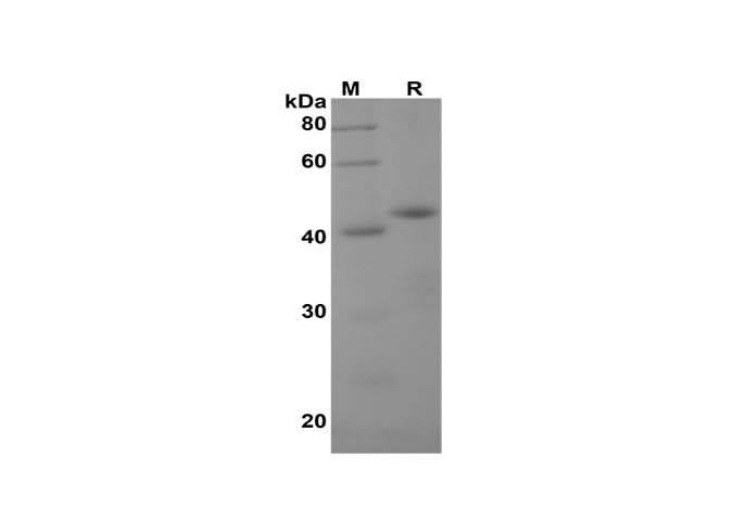 SDS-PAGE analysis of Human Annexin A1/ANXA1 proteins, 2 μg/lane of Recombinant Human Annexin A1/ANXA1 proteins was resolved with SDS-PAGE under reducing conditions, showing bands at 45 kDa.