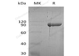 Recombinant Human Diamine Oxidase/AOC1 Protein (His Tag) - ABMIUM