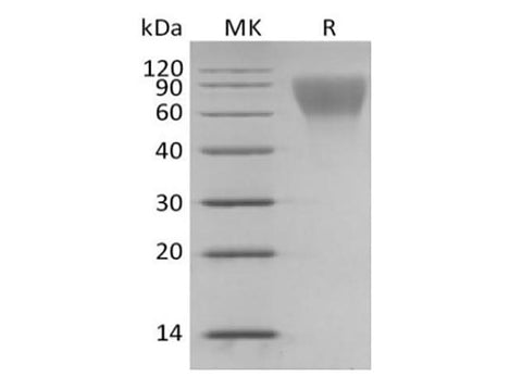 Recombinant Human Hematopoietic progenitor cell antigen CD34/CD34 (C-6His) - ABMIUM