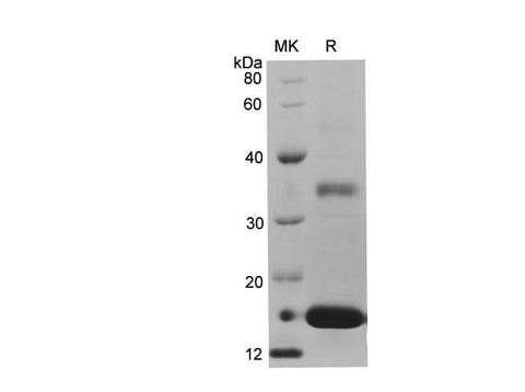SDS-PAGE analysis of Mouse REG4 proteins, 2 μg/lane of Recombinant Mouse REG4 proteins was resolved with SDS-PAGE under reducing conditions, showing bands at 18.31 kDa.