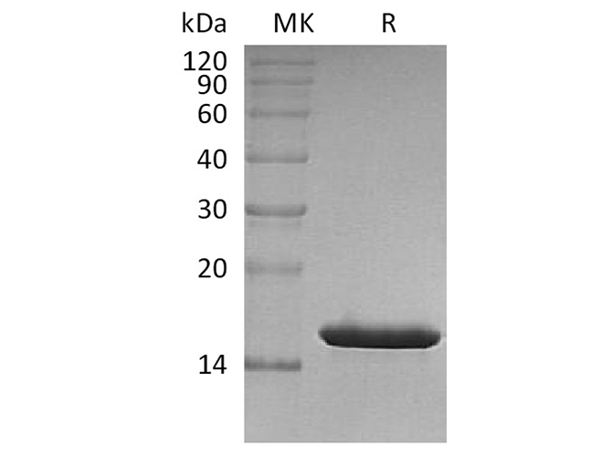 Recombinant Human FABP4/A-FABP Protein (His Tag) - ABMIUM