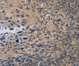 Anti-Human/Mouse/Rat NOX1 Antibody - ABMIUM