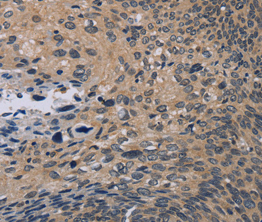 Anti-Human/Mouse/Rat NOX1 Antibody - ABMIUM