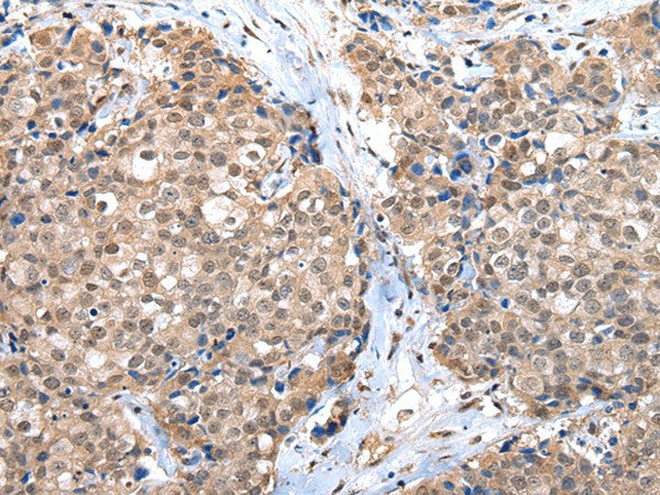 Anti-Human/Mouse/Rat CTBP1 Antibody - ABMIUM