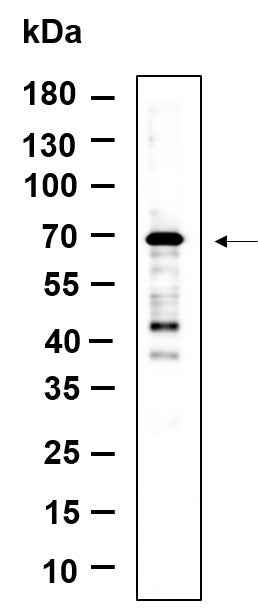 Anti-Human/Mouse/Rat NF2 Antibody [B918] - ABMIUM