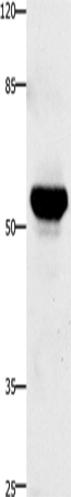 Anti-Human TNFRSF21 Antibody - ABMIUM