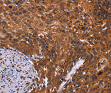 Anti-Human/Mouse/Rat CDC5L Antibody - ABMIUM