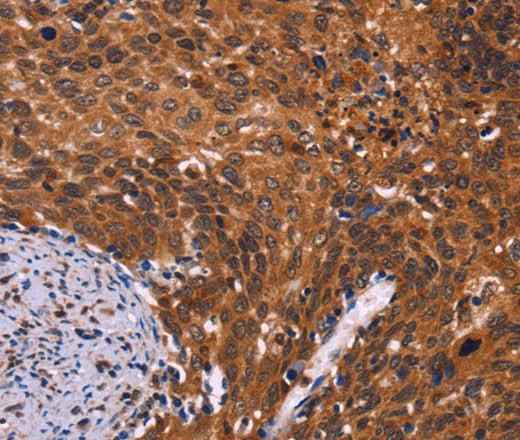 Anti-Human/Mouse/Rat CDC5L Antibody