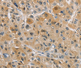 Anti-Human NAPSA Antibody - ABMIUM