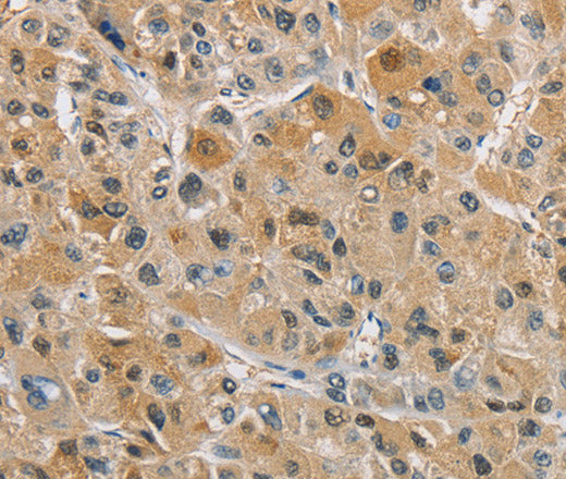 Anti-Human NAPSA Antibody - ABMIUM