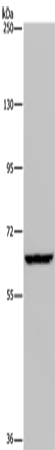 Anti-Human IVL Antibody - ABMIUM