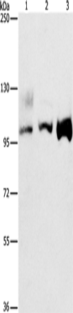 Anti-Human/Mouse ASCC2 Antibody - ABMIUM