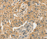 Anti-Human/Mouse/Rat SLC11A2 Antibody - ABMIUM