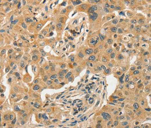 Anti-Human/Mouse/Rat SLC11A2 Antibody