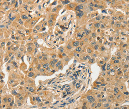 Anti-Human/Mouse/Rat SLC11A2 Antibody - ABMIUM