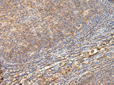 Immunohistochemistry of paraffin-embedded Human tonsil tissue using ADGRA1 Polyclonal Antibody at dilution of 1:70(×200)