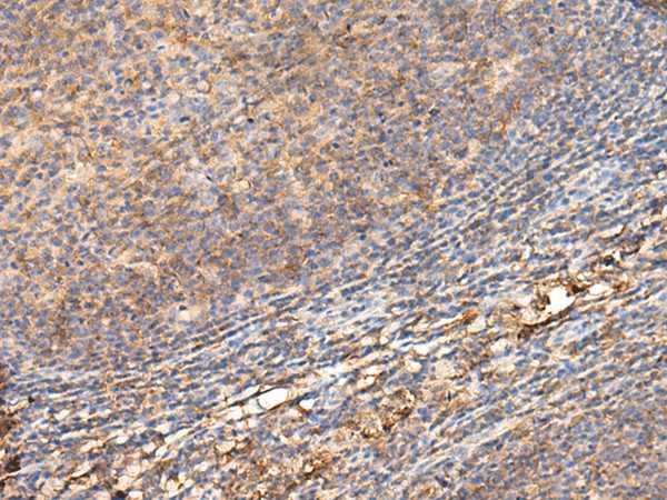 Immunohistochemistry of paraffin-embedded Human tonsil tissue using ADGRA1 Polyclonal Antibody at dilution of 1:70(×200)