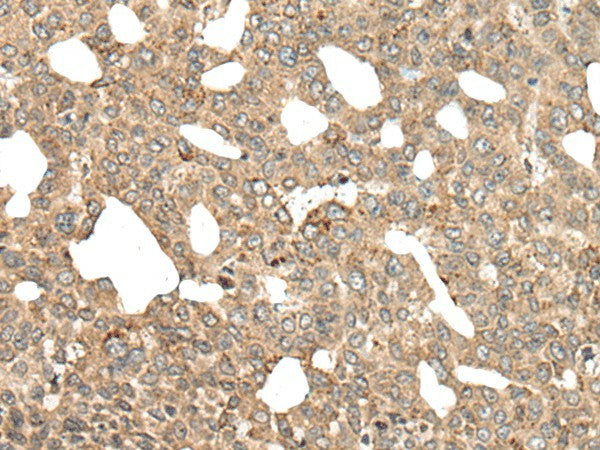 Anti-Human/Mouse/Rat APC Antibody - ABMIUM