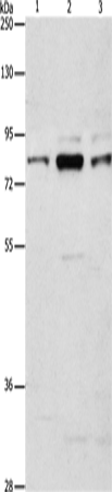 Anti-Human/Mouse/Rat ARHGEF7 Antibody - ABMIUM