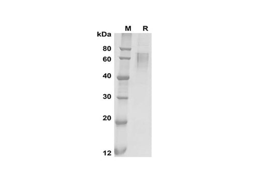 SDS-PAGE analysis of Mouse Il17ra proteins, 2 μg/lane of Recombinant Mouse Il17ra proteins was resolved with SDS-PAGE under reducing conditions, showing bands at 50-65 kDa.