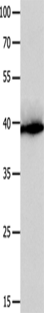 Anti-Human CFHR1 Antibody - ABMIUM