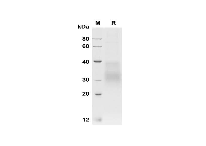 SDS-PAGE analysis of Human HVEM/TNFRSF14 proteins, 2 μg/lane of Recombinant Human HVEM/TNFRSF14 proteins was resolved with SDS-PAGE under reducing conditions, showing bands at 30-35 kDa.