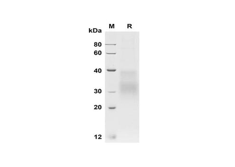 SDS-PAGE analysis of Human HVEM/TNFRSF14 proteins, 2 μg/lane of Recombinant Human HVEM/TNFRSF14 proteins was resolved with SDS-PAGE under reducing conditions, showing bands at 30-35 kDa.