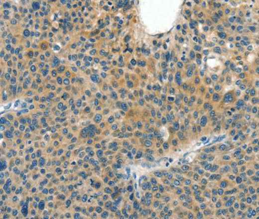 Anti-Human CRLF2 Antibody