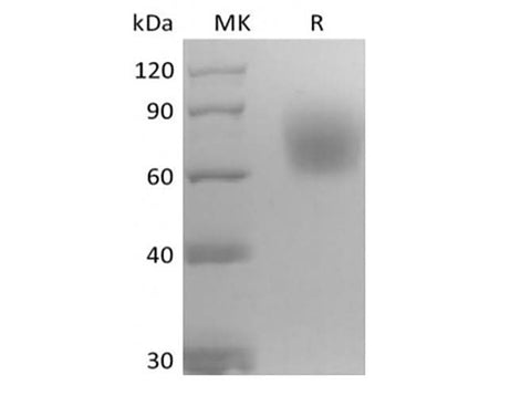 Recombinant Mouse Neurotrophic Tyrosine Kinase Receptor Type 2/TrkB/NTRK2 (C-6His) - ABMIUM