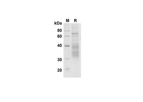 SDS-PAGE analysis of Mouse Clusterin proteins , 2 μg/lane of Recombinant Mouse Clusterin proteins was resolved with SDS-PAGE under reducing conditions , showing bands at 35-45 kDa.