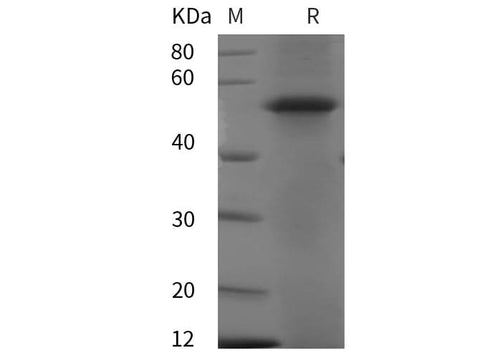 SDS-PAGE analysis of Human XIAP proteins, 2 μg/lane of Recombinant Human XIAP proteins was resolved with SDS-PAGE under reducing conditions, showing bands at 54 kDa.