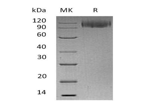 Recombinant Human LAMP1/CD107a Protein (Fc Tag) - ABMIUM